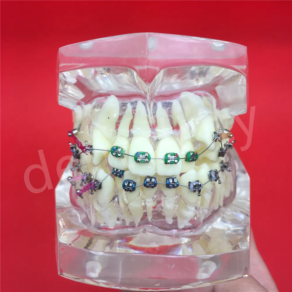 Изображение /thumbs_3-content/Стоматологични-модели-на-зъби_63202.jpeg