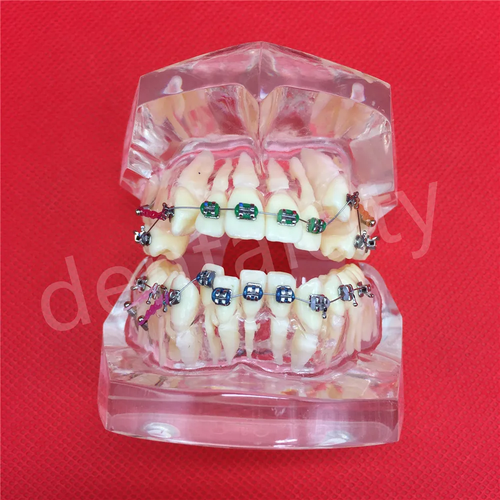 Изображение /thumbs_4-content/Стоматологични-модели-на-зъби_63202.jpeg