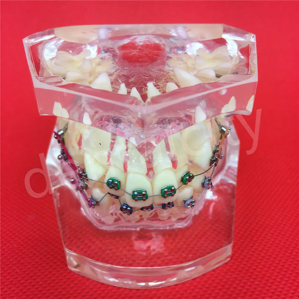 Изображение /thumbs_5-content/Стоматологични-модели-на-зъби_63202.jpeg