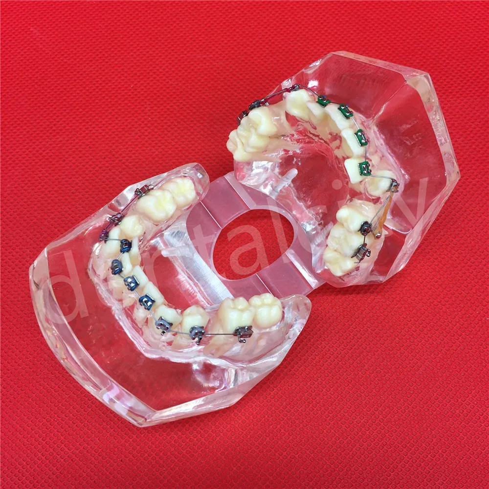 Изображение /thumbs_6-content/Стоматологични-модели-на-зъби_63202.jpeg